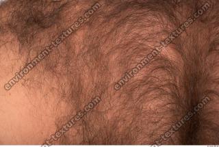 human skin hairy 0005